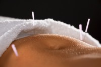 acupuncture abdomen