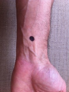 Acu-point
